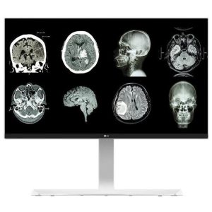 Monitor IPS de 8MP- LG 27" (Medical grade)