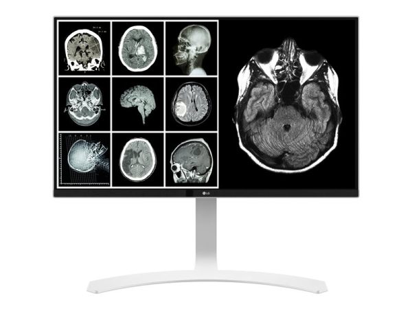 Monitor IPS de 8MP- LG 27" (Medical grade)