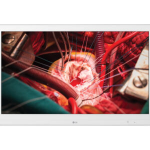 monitor cirúrgico lg 27 polegadas