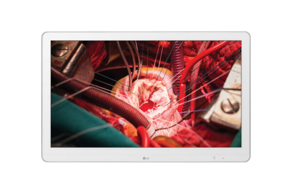 monitor cirúrgico lg 27 polegadas