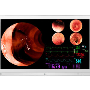 monitor cirurgico 32 polegadas