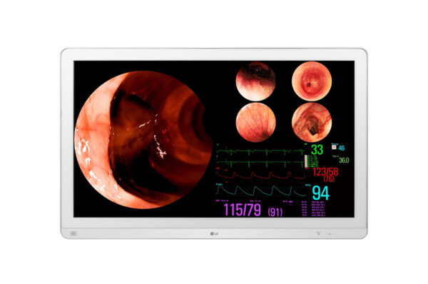monitor cirurgico 32 polegadas