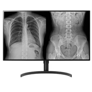 monitor diagnóstico lg 32 polegadas