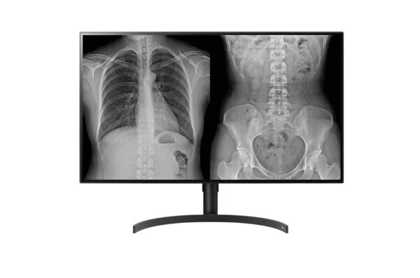 monitor diagnóstico lg 32 polegadas