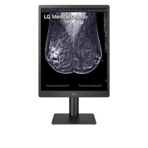 monitor diagnóstico para mamografia