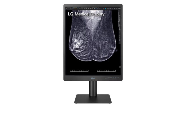 monitor diagnóstico para mamografia