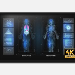 monitor médico tátil de 32 polegadas e resolução 4K