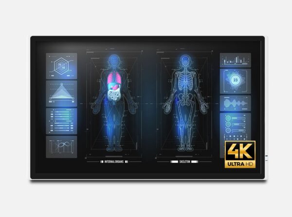 monitor médico tátil de 32 polegadas e resolução 4K