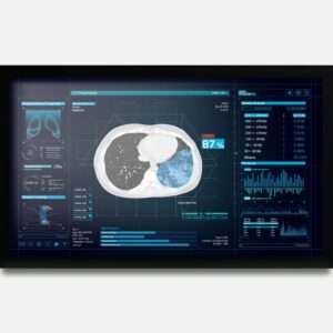monitor de 27 polegadas para hospitais com certificação DICOM