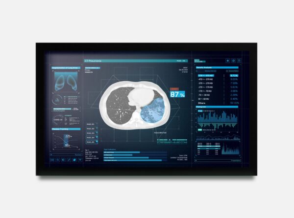 monitor de 27 polegadas para hospitais com certificação DICOM