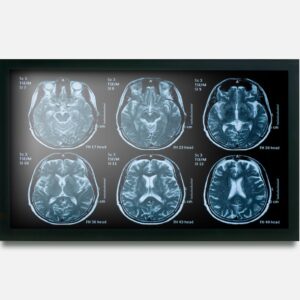 monitor hospitalar de 22 polegadas e multitoque