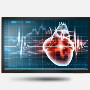 monitor medico tatil de 15,6 polegadas e resolução full HD