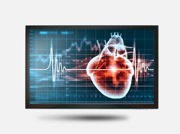 monitor medico tatil de 15,6 polegadas e resolução full HD