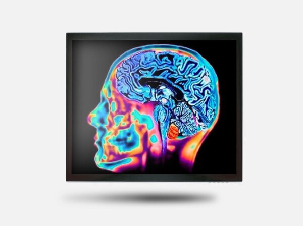 monitor multitoque de 15 polegadas para hospitais e centros de saude