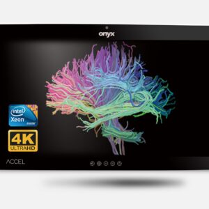 computador AIO médico 4K de 32 polegadas