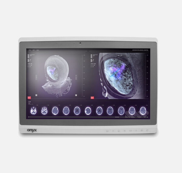 computador all-in-one 24 pol sem ventoinha