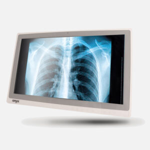 pc all-in-one de 22 pol para hospitais